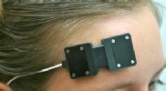 PL on frontal head - close up.jpg
